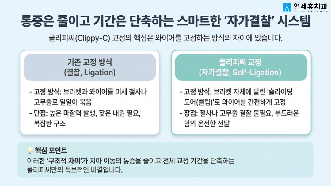슬라이딩 도어 방식(클립)으로 마찰력을 줄여 통증과 교정 기간을 단축하는 클리피씨 자가결찰(Self-Ligation) 시스템 원리