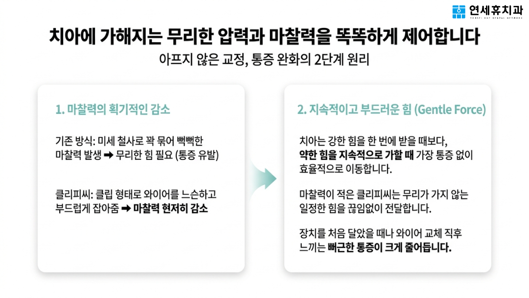 마찰력의 획기적인 감소와 지속적이고 부드러운 힘(Gentle Force) 전달로 치아 이동 시 통증을 완화하는 아프지 않은 교정 원리