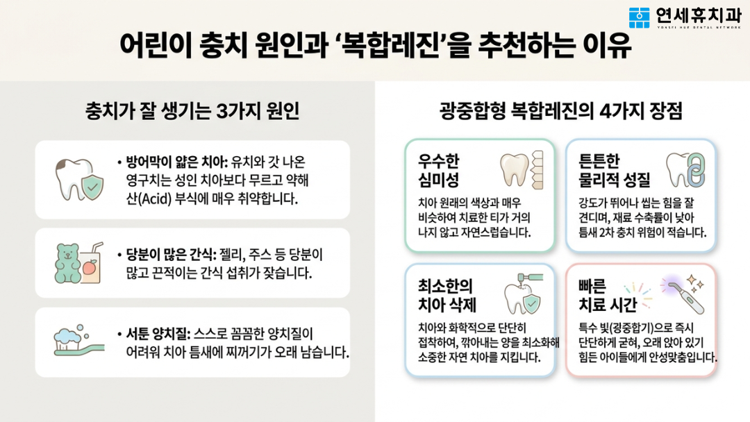 소아충치가 잘 생기는 원인 3가지 및 우수한 심미성과 최소 삭제 등 광중합형 복합레진 치료를 추천하는 4가지 이유