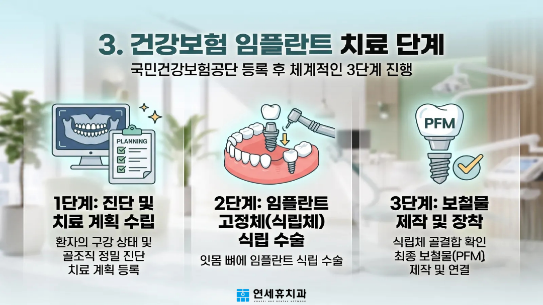 체계적인 건강보험 임플란트 치료 3단계 과정 (1단계 진단 및 치료 계획, 2단계 고정체 식립 수술, 3단계 보철물 장착)