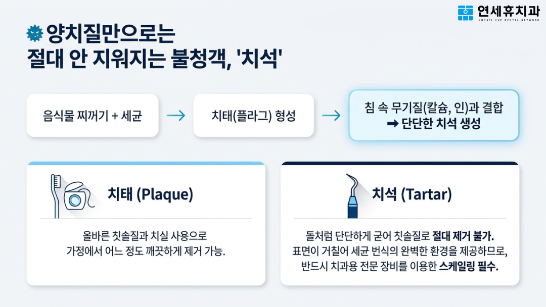 양치질만으로는 절대 지워지지 않는 단단한 치석 생성 과정(치태에서 치석으로) 및 아현동치과 전문 장비를 이용한 스케일링의 필요성