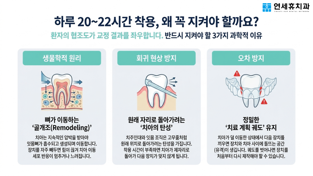 인비절라인 하루 20시간 이상 착용 필수 이유: 뼈가 이동하는 골개조 원리, 치아 회귀 현상 방지, 정밀한 치료 계획 오차 방지